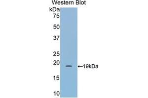 Western blot analysis of the recombinant protein. (LCAT anticorps  (AA 290-434))
