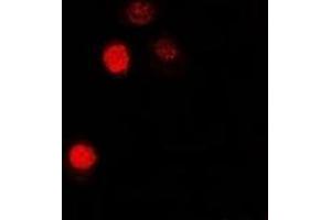 Immunofluorescent analysis of MATH-1 staining in U2OS cells. (ATOH1 anticorps)