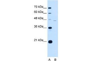 WB Suggested Anti-SIGLEC9 Antibody Titration:  0. (SIGLEC9 anticorps  (C-Term))