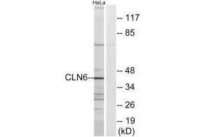Western blot analysis of extracts from HeLa cells, using CLN6 antibody. (CLN6 anticorps)