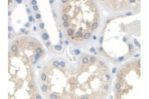 Detection of OXCT1 in Human Kidney Tissue using Polyclonal Antibody to 3-Oxoacid Coenzyme A Transferase 1 (OXCT1) (OXCT1 anticorps  (AA 40-489))