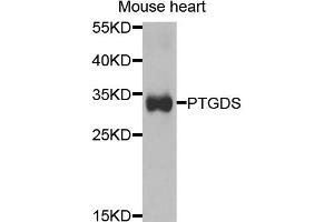 Western blot analysis of extracts of mouse heart, using PTGDS antibody. (PTGDS anticorps)