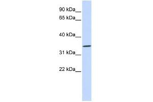 WB Suggested Anti-RHCE Antibody Titration:  0. (RHCE anticorps  (N-Term))