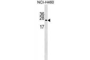 Western Blotting (WB) image for anti-Ribosomal Protein L10a (RPL10A) antibody (ABIN2999207) (RPL10A anticorps)