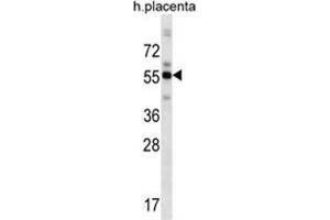 ZBTB8B Antibody (C-term) (AP54617PU-N ) western blot analysis in human placenta tissue lysates (35 µg/lane).