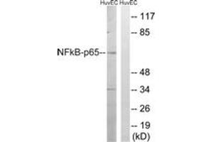 Western blot analysis of extracts from HuvEc cells, treated with EPO 20U/ml 15', using NF-kappaB p65 (Ab-281) Antibody. (NF-kB p65 anticorps  (AA 247-296))