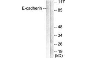 Western blot analysis of extracts from 293 cells, using E-cadherin Antibody.