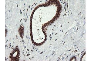 Image no. 5 for anti-TAP Binding Protein-Like (TAPBPL) antibody (ABIN1501300)