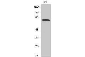 Western Blotting (WB) image for anti-Bruton Agammaglobulinemia tyrosine Kinase (BTK) (Ser189) antibody (ABIN3183568) (BTK anticorps  (Ser189))