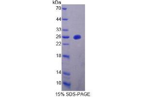 SDS-PAGE analysis of Mouse MTUS1 Protein. (MTUS1 Protéine)