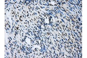 Immunohistochemical staining of paraffin-embedded liver tissue using anti-GBE1 mouse monoclonal antibody. (GBE1 anticorps)
