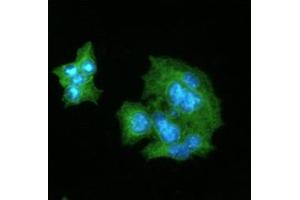 ICC/IF analysis of CRP in HepG2 cells line, stained with DAPI (Blue) for nucleus staining and monoclonal anti-human CRP antibody (1:100) with goat anti-mouse IgG-Alexa fluor 488 conjugate (Green).