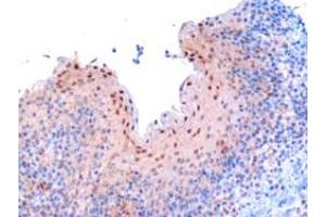 ABIN185045 (3 µg/mL) staining of paraffin embedded human tonsil. (Importin 9 anticorps  (C-Term))