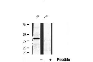 Western blot analysis of extracts of A2780 cells, using NDE1 antibody. (NDE1 anticorps  (N-Term))