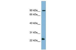 VPS29 antibody used at 1 ug/ml to detect target protein.