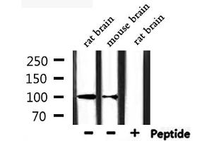 Western blot analysis of extracts from rat brain, mouse brain, using CHSY3 Antibody. (CHSY3 anticorps  (N-Term))