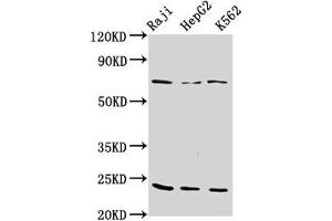 Western Blot Positive WB detected in: Raji whole cell lysate, HepG2 whole cell lysate, K562 whole cell lysate All lanes: PSMB9 antibody at 10 μg/mL Secondary Goat polyclonal to rabbit IgG at 1/50000 dilution Predicted band size: 24, 23 kDa Observed band size: 24 kDa