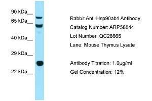 Western Blotting (WB) image for anti-Heat Shock Protein 90kDa alpha (Cytosolic), Class B Member 1 (HSP90AB1) (N-Term) antibody (ABIN2787849) (HSP90AB1 anticorps  (N-Term))