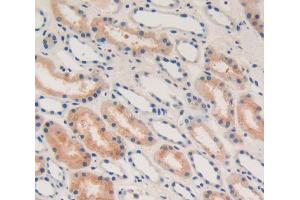 Used in DAB staining on fromalin fixed paraffin- embedded Kidney tissue (IFNA anticorps  (AA 24-189))