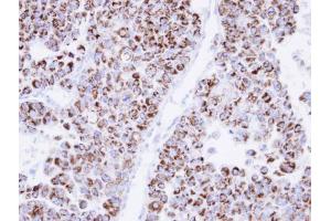 IHC-P Image Immunohistochemical analysis of paraffin-embedded OV90 xenograft, using ECH1, antibody at 1:500 dilution.