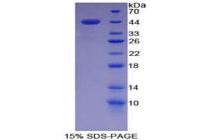 SDS-PAGE analysis of Pig Complement Component 7 Protein. (C7 Protéine)