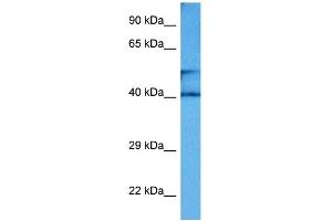Host:  Mouse  Target Name:  CKM  Sample Tissue:  Mouse Small Intestine  Antibody Dilution:  1ug/ml (CKM anticorps  (Middle Region))