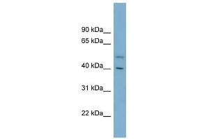B4GALT2 antibody used at 1 ug/ml to detect target protein. (B4GALT2 anticorps  (Middle Region))