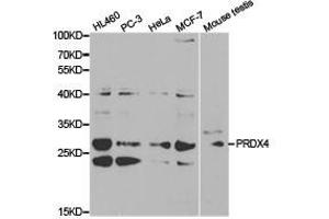 Western Blotting (WB) image for anti-Peroxiredoxin 4 (PRDX4) antibody (ABIN1874258) (Peroxiredoxin 4 anticorps)