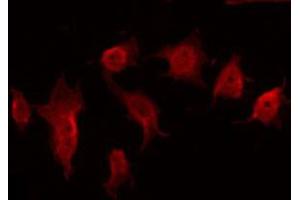 ABIN6272348 staining COLO205 by IF/ICC.