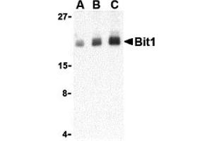 Western Blotting (WB) image for anti-Peptidyl-tRNA Hydrolase 2 (PTRH2) (Middle Region) antibody (ABIN1030890) (PTRH2 anticorps  (Middle Region))