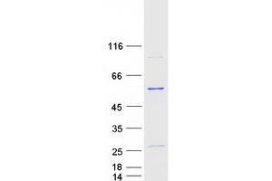 Validation with Western Blot