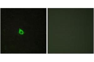 Immunofluorescence analysis of HepG2 cells, using RECK Antibody. (RECK anticorps  (AA 21-70))