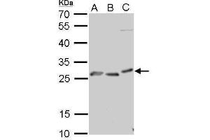 WB Image PRP antibody detects PRNP protein by Western blot analysis. (PRNP anticorps)