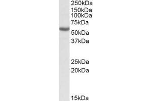ABIN571184 (0. (ALDH3B1 anticorps  (Internal Region))