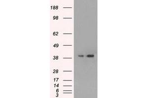 HEK293T cells were transfected with the pCMV6-ENTRY control (Left lane) or pCMV6-ENTRY MAPK1 (Right lane) cDNA for 48 hrs and lysed. (ERK2 anticorps)