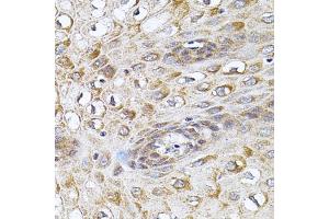 Immunohistochemistry of paraffin-embedded human esophagus using CETP antibody (ABIN5970634) (40x lens). (CETP anticorps)