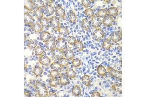 Immunohistochemistry of paraffin-embedded rat kidney using SYT1 antibody (ABIN5970380) at dilution of 1/200 (40x lens). (SYT1 anticorps)