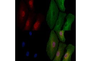 ABIN6257072 and ABIN6273592 staining  cells by IF/ICC. (CPEB1 anticorps  (Internal Region))