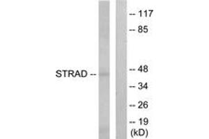 Western blot analysis of extracts from HepG2 cells, using STRAD Antibody. (STRADA anticorps  (AA 11-60))