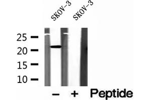 Western blot analysis of extracts of SKOV-3 cells, using ICT1 antibody. (ICT1 anticorps)
