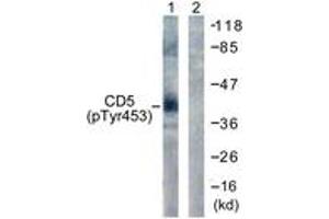Western blot analysis of extracts from 293 cells treated with PMA 125ng/ml 30' , using CD5 (Phospho-Tyr453) Antibody. (CD5 anticorps  (pTyr453))