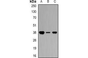 Western blot analysis of Ciao 1 expression in Jurkat (A), mouse kidney (B), rat heart (C) whole cell lysates. (CIAO1 anticorps)