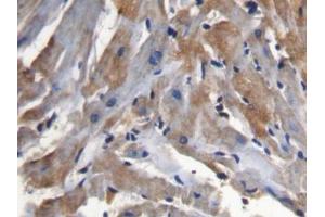 IHC-P analysis of Mouse Cardiac Muscle Tissue, with DAB staining. (SFRP1 anticorps  (AA 32-314))