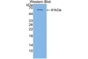 Western blot analysis of the recombinant protein. (TGFBR3 anticorps  (AA 469-724))