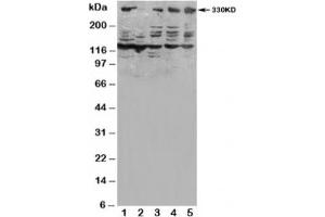 Western blot testing of ATM antibody and Lane 1:  HeLa;  2: SMMC-7721;  3: U87;  4: A549;  5: MCF-7 (ATM anticorps  (N-Term))