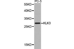 Western blot analysis of extracts of PC-3 cell lines, using KLK3 antibody. (Prostate Specific Antigen anticorps  (AA 1-100))