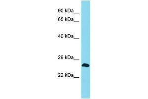 Western Blotting (WB) image for anti-MLLT4 Antisense RNA 1 (Head To Head) (MLLT4-AS1) (Middle Region) antibody (ABIN2791468) (MLLT4-AS1 anticorps  (Middle Region))