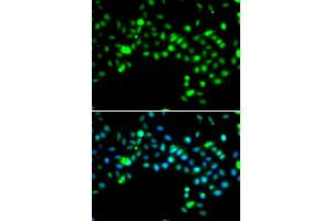 Immunofluorescence analysis of MCF-7 cells using SRSF4 antibody. (SRSF4 anticorps)