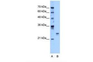 Image no. 1 for anti-High Mobility Group Box 1 (HMGB1) (AA 126-175) antibody (ABIN324443) (HMGB1 anticorps  (AA 126-175))