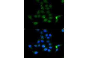 Immunofluorescence analysis of MCF7 cell using TAT antibody.